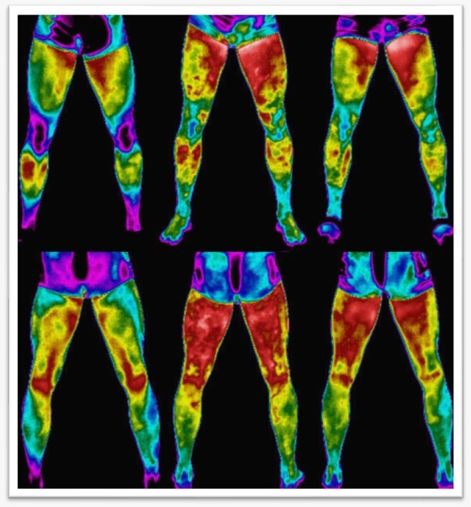 Avaliação integrada do atleta: termografia, biomarcadores e genética
